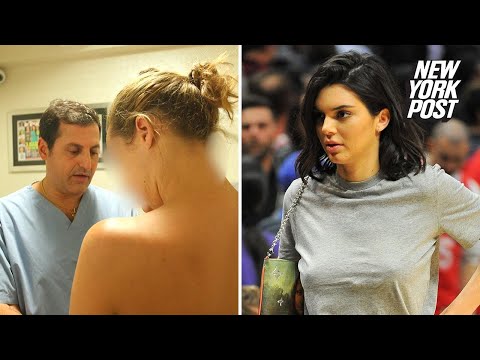 How Women Get Designer Nipples to Look Like Kendall Jenner | New York Post