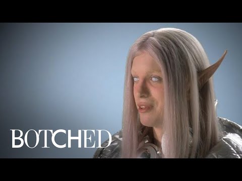 &quot;Botched&quot; Patient Wants to Be the Perfect Space Elf | E!